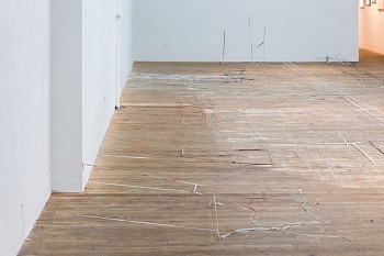 Olga Balema - brain damage